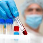 La Belgique compte 757 cas confirmés de variole du singe