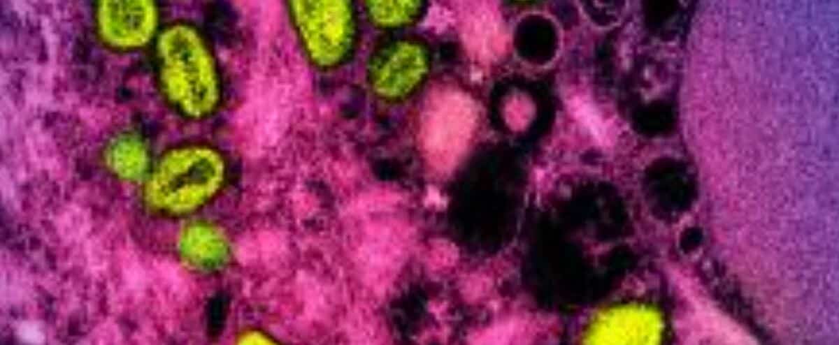 L'OMS change le nom officiel de la variole du singe