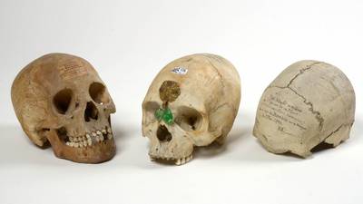 Trois crânes issus de la période coloniale mis en vente: Ecolo veut interdire le commerce de restes humains